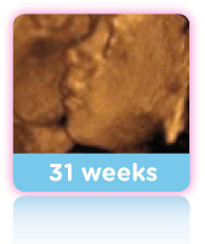 31 Weeks Baby Scan