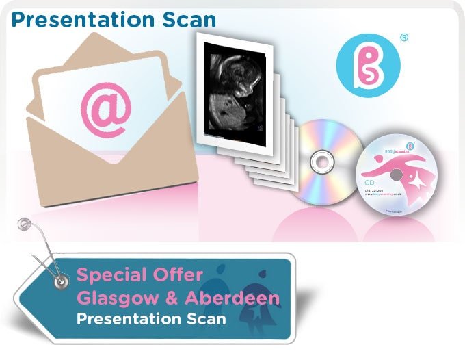 presentation scan london