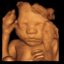 Seeing The Baby With Baby Scan