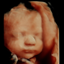 Is an Early Pregnancy Scan Right for You?