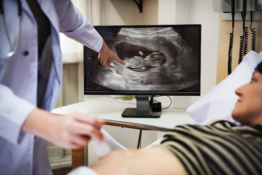 Early Prenatal Ultrasound